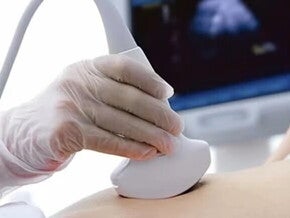 Mujer con embarazo ectópico haciéndose una ecografía.