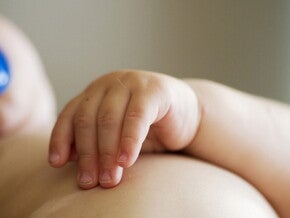 Obesidad
