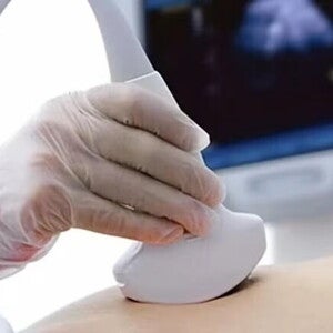 Mujer con embarazo ectópico haciéndose una ecografía.