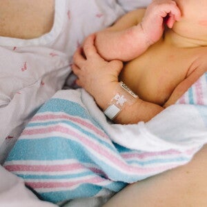 Ictericia neonatal Ictericia neonatal