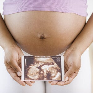 ¿Las futuras mamás no necesitan comer por dos? ¿Las futuras mamás no necesitan comer por dos?