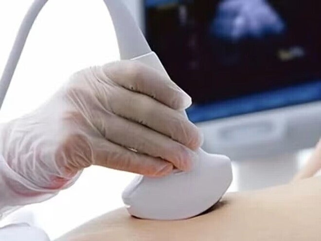 Mujer con embarazo ectópico haciéndose una ecografía.