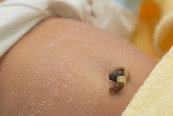 Cuidados Basicos del Bebe Cordon umbilical